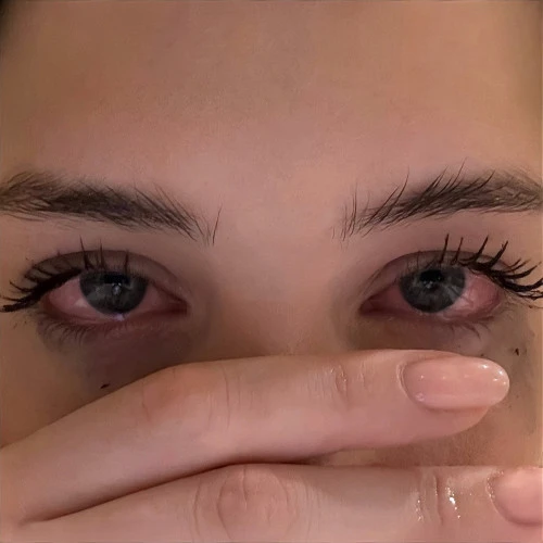 Красные глаза